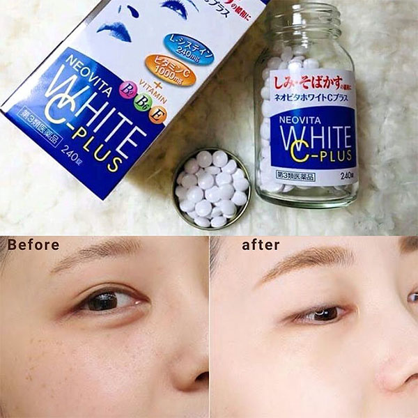 Viên uống trắng da Kokando Neovita White C Plus