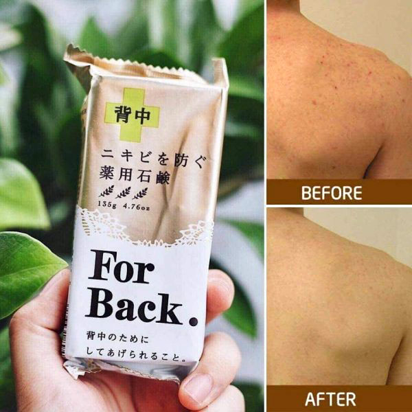 Xà phòng trị mụn lưng ForBack